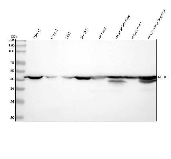 WB - Anti-Actin ACTA1 Rabbit Monoclonal Antibody ABO13566